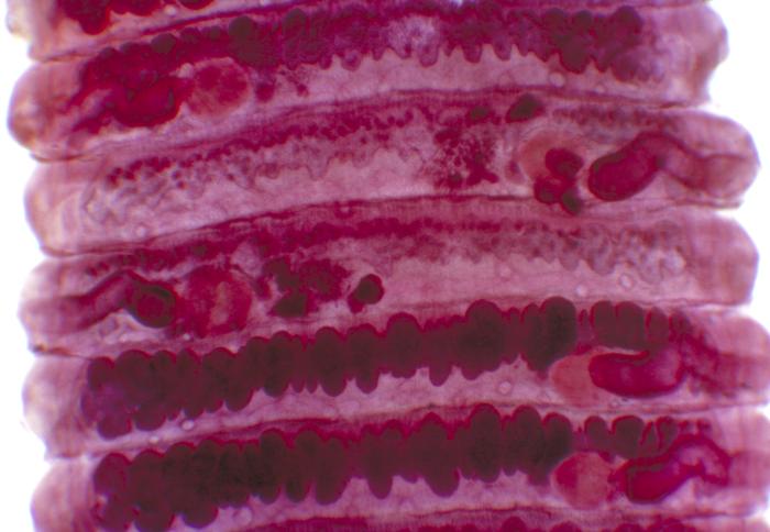 Proglottids of tapeworm Bertiella studeri.jpg