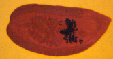 Artyfechinostomum malayanum.jpg