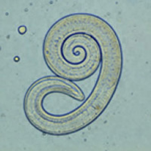 Файл:Trichinella larv1 DPDx.JPG