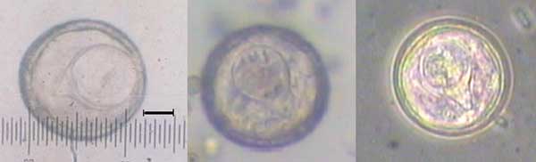 Eggs of tapeworm Bertiella studeri.jpg